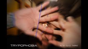 Trypophobia by Dr. Cyril Thomas