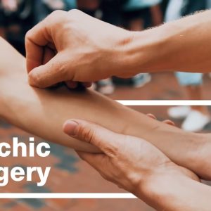 Psychic Surgery by Aaron Alexander